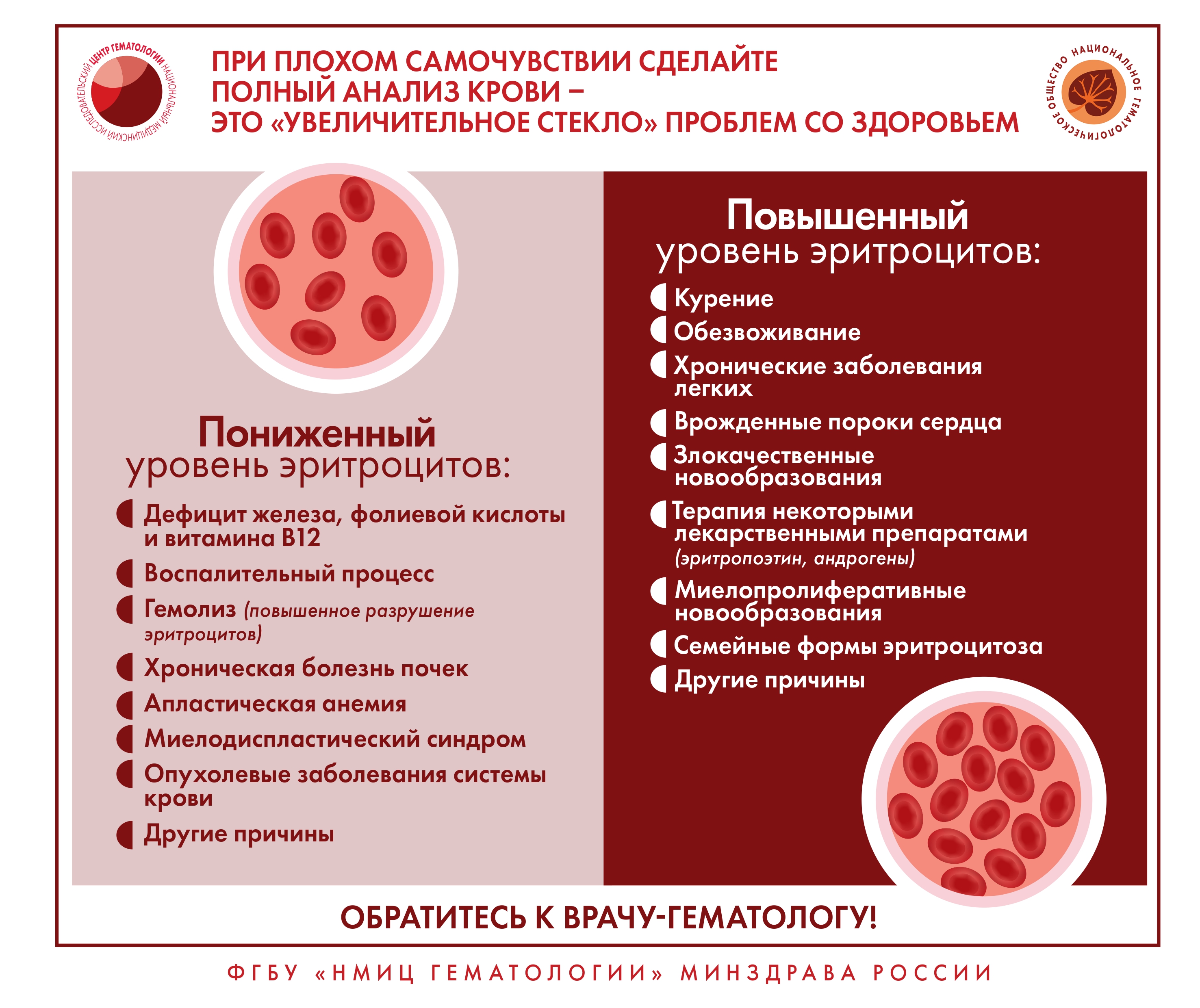 Неходжкинская лимфома картина крови